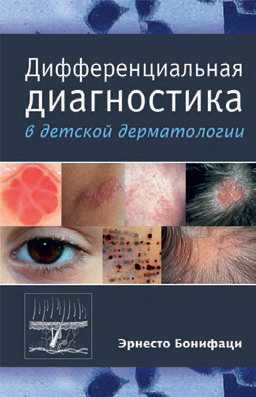 Дифференциальная диагностика в детской дерматологии